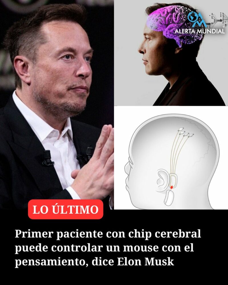 El primer paciente humano al que se le implantó un chip cerebral de