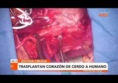 Cirujanos logran trasplantar un corazón de cerdo a una persona en EE UU