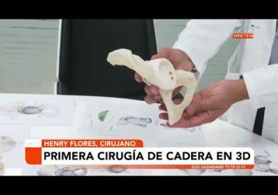 Primera cirugía de cadera en 3D en Bolivia