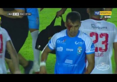 Óscar Vaca se fue expulsado por un terrible codazo sobre Jesús Sagredo