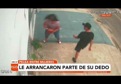 Mujer le arrancó el dedo de una mordida
