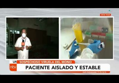 Paciente sospechoso de viruela del mono se encuentra aislado