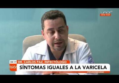 Expertos aseguran que viruela del mono es solo 1% letal