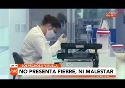 Sospechoso de viruela del mono se encuentra estable