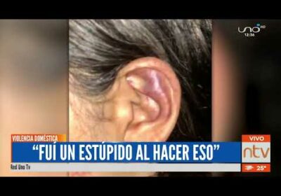 «Lo hice por celos», fueron las palabras del hombre acusado de intento de feminicidio