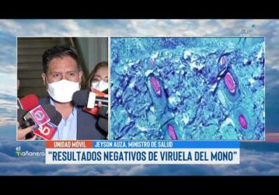Ministro de Salud descarta presencia de la Viruela del Mono en el país
