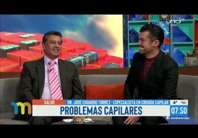 La alopecia, sus causas y tratamiento.