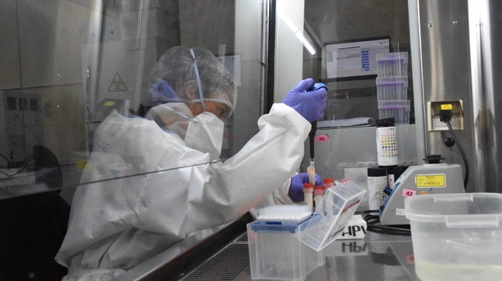 Casos de viruela símica se centralizan en Santa Cruz, La Paz y Cochabamba