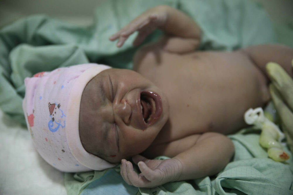 Un bebé recién nacido llora después de una operación de cesárea por parte de trabajadoras de maternidad en el Centro Hospitalario Fontaine. (AP Photo/Odelyn Joseph)

