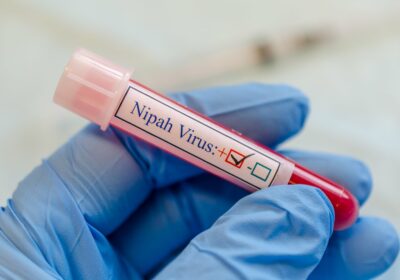 INFORMACIÓN SÚPER IMPORTANTE: Todo lo que necesitas saber sobre el Virus NIPAH: En estos…