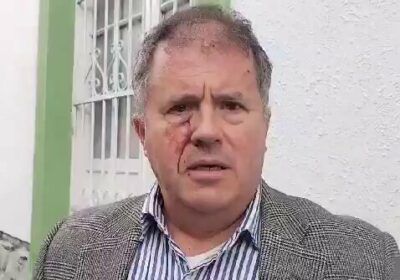 El diputado de Comunidad Ciudadana (CC) Miguel Roca denuncia que fue agredido por su…