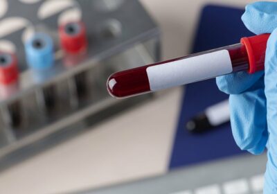 🇯🇵 | LO ÚLTIMO: Japón comenzó a probar sangre artificial en humanos. Científicos japoneses…