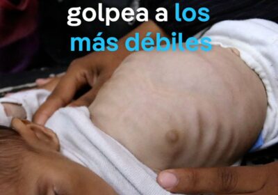 OMS: Gaza sufre una «hambruna masiva generada por el hombre» El bloqueo de la…