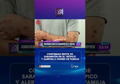 Confirman brote de sarampión en el trópico y alertan a padres de familia