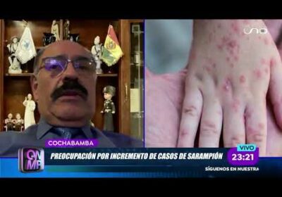 Anibal Cruz alerta por brote de sarampión y baja vacunación en Bolivia